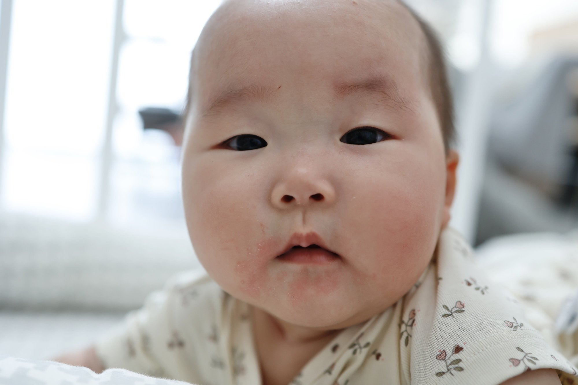赤ちゃんのよだれかぶれの原因と毎日のケア【助産師監修】