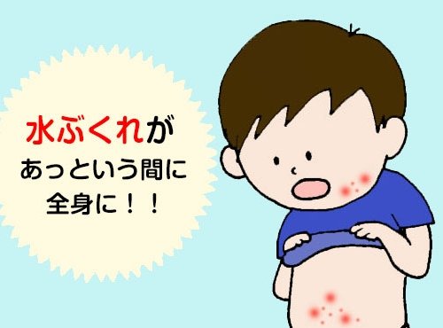 とても簡単!赤ちゃんや子どもがとびひになったときに守る3項目