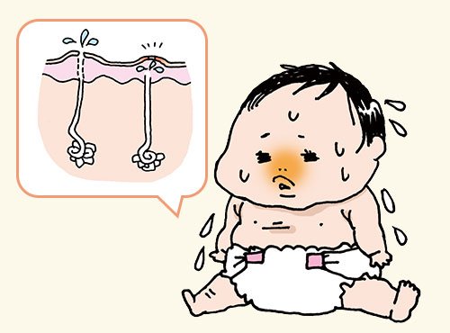 赤ちゃんのあせもを予防する、スキンケア4ポイント