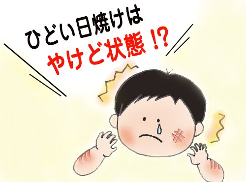 子どものうっかり日焼けはその日のうちにケアが重要です!
