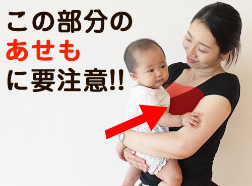 ベビーに気をとられていたら自分に!?産後は胸元のあせもに要注意!!