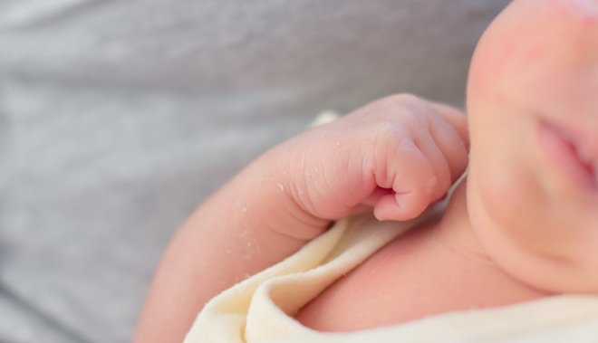 【医師監修】新生児（生後0～2か月）に多い「乳児湿疹（乳児脂漏性皮膚炎）」って？