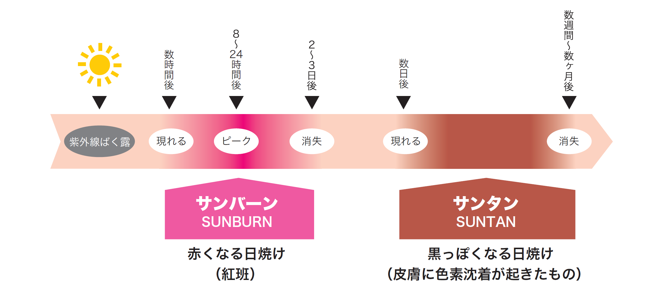 サンバーンとサンタンの違い