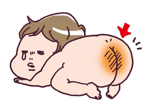 赤ちゃんのおむつかぶれ対策は?おしりのケア方法をここでおさらい!