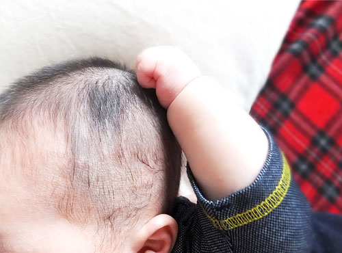 赤ちゃんの頭皮のフケ カサつきの原因は 乾燥頭皮トラブルの予防と対策 ベビー 赤ちゃん ナチュラルサイエンス For Mama Kids Smile