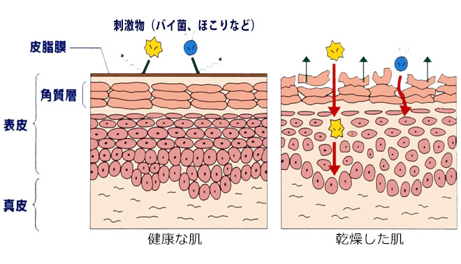 赤いリンゴほっぺやサラサラ肌はng 赤ちゃんの肌の乾燥状態をチェック ベビー 赤ちゃん ナチュラルサイエンス For Mama Kids Smile