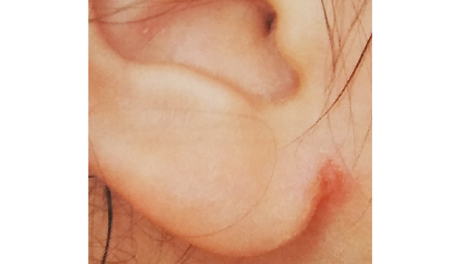 医師監修 アトピーって アレルギーって 赤ちゃんに多い アトピー性皮膚炎 を正しく知ろう ベビー 赤ちゃん ナチュラルサイエンス For Mama Kids Smile