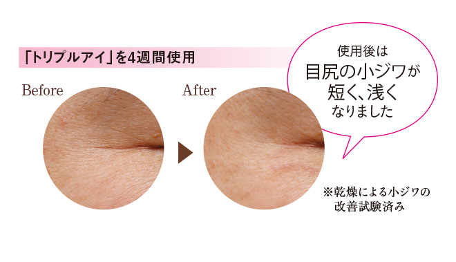 シワ試験済 目元のシワ ほうれい線に 冬は アイケアクリーム を取り入れましょう 美容 ナチュラルサイエンス For Mama Kids Smile