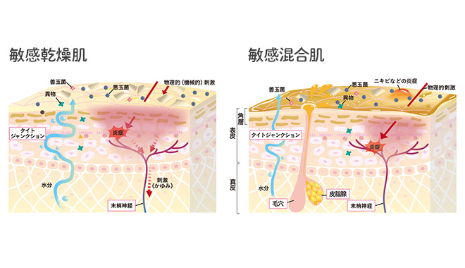 春先は特に注意 敏感混合肌 の実態と正しいケア方法とは お知らせ ナチュラルサイエンス For Mama Kids Smile