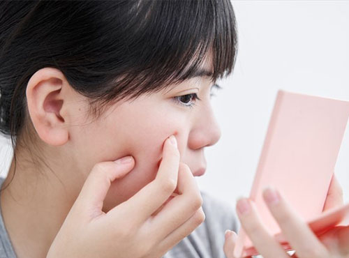 11 17歳頃 思春期ニキビ肌 のスキンケア方法って キッズ 子ども ナチュラルサイエンス For Mama Kids Smile