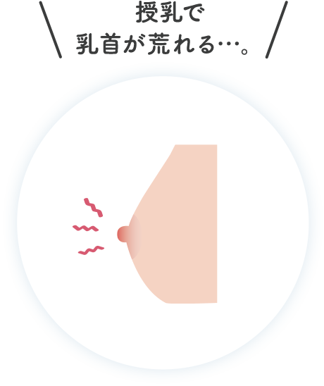 授乳で乳首が荒れる…。