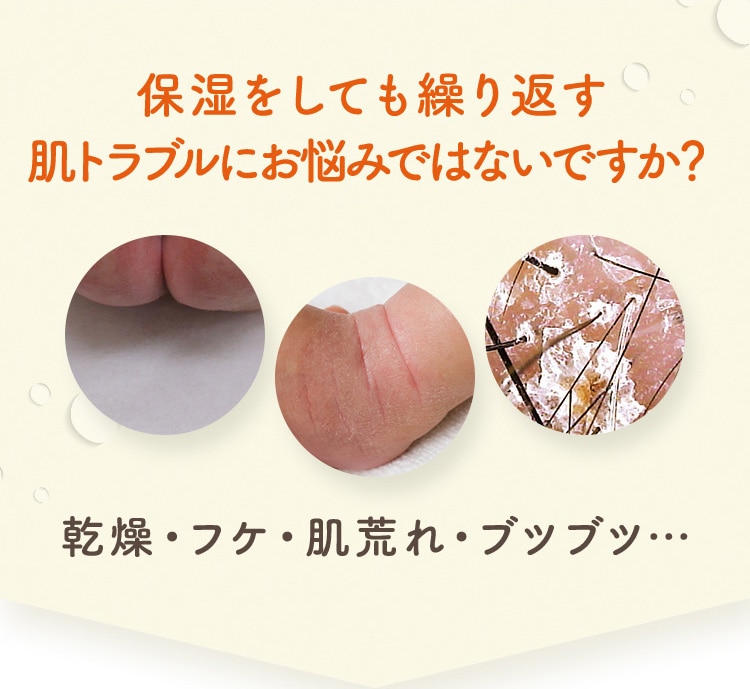 保湿をしても繰り返す肌トラブルにお悩みではないですか? 乾燥・フケ・肌荒れ・ブツブツ…