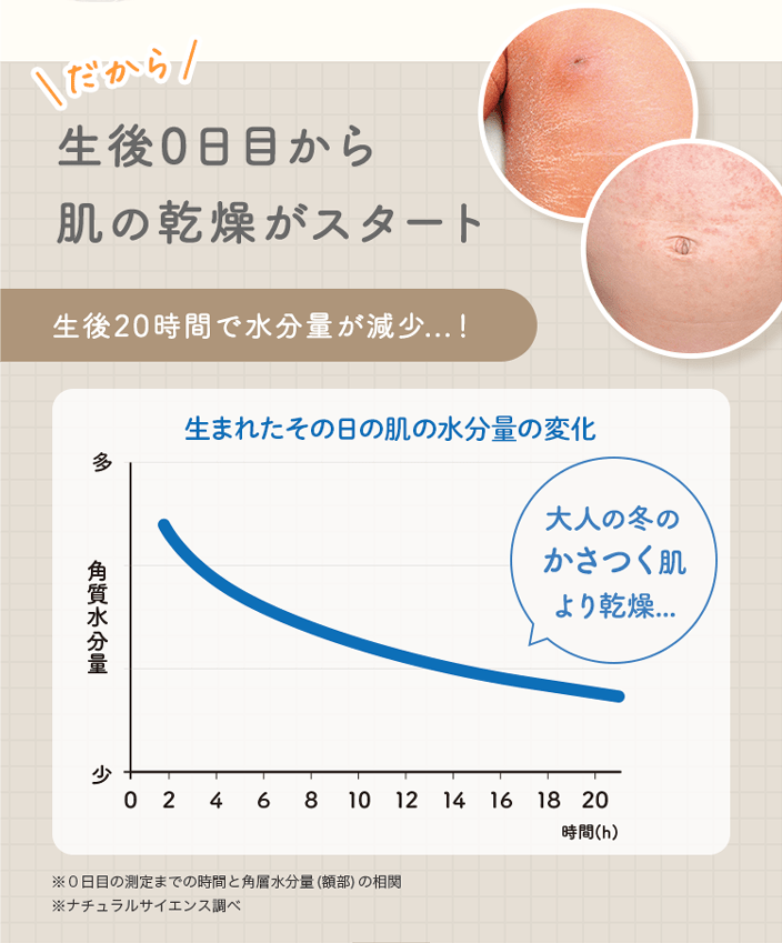 だから生後0日目から肌の乾燥がスタート 生後20時間で水分量が減少...！ 大人の冬のかさつく肌より乾燥...