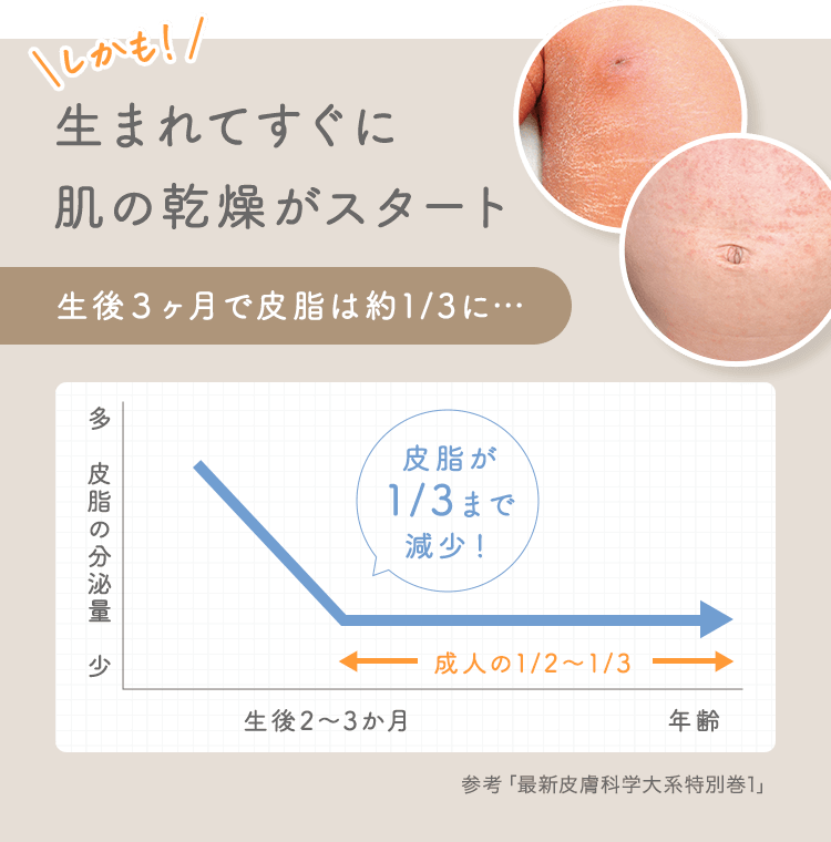 しかも生まれてすぐに 肌の乾燥がスタート