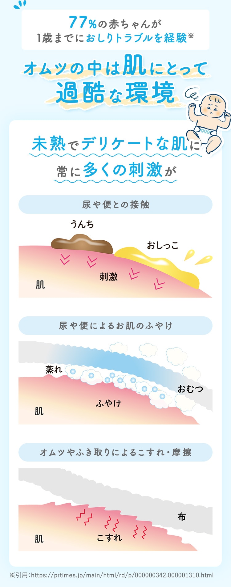 77%の赤ちゃんが1歳までにおしりトラブルを経験※ オムツの中は肌にとって過酷な環境 未熟でデリケートな肌に常に多くの刺激が