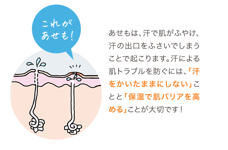 これがあせも！ あせもは、汗で肌がふやけ、汗の出口をふさいでしまうことで起こります。汗による肌トラブルを防ぐには、「汗をかいたままにしない」ことと「保湿で肌バリアを高める」ことが大切です！
