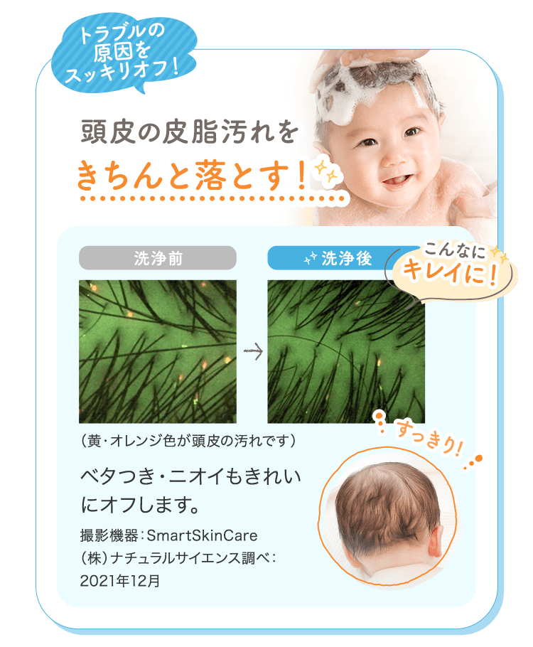 トラブルの原因をスッキリオフ！|頭皮の皮脂汚れをきちんと落とす！ベタつき・ニオイもきれいにオフします。