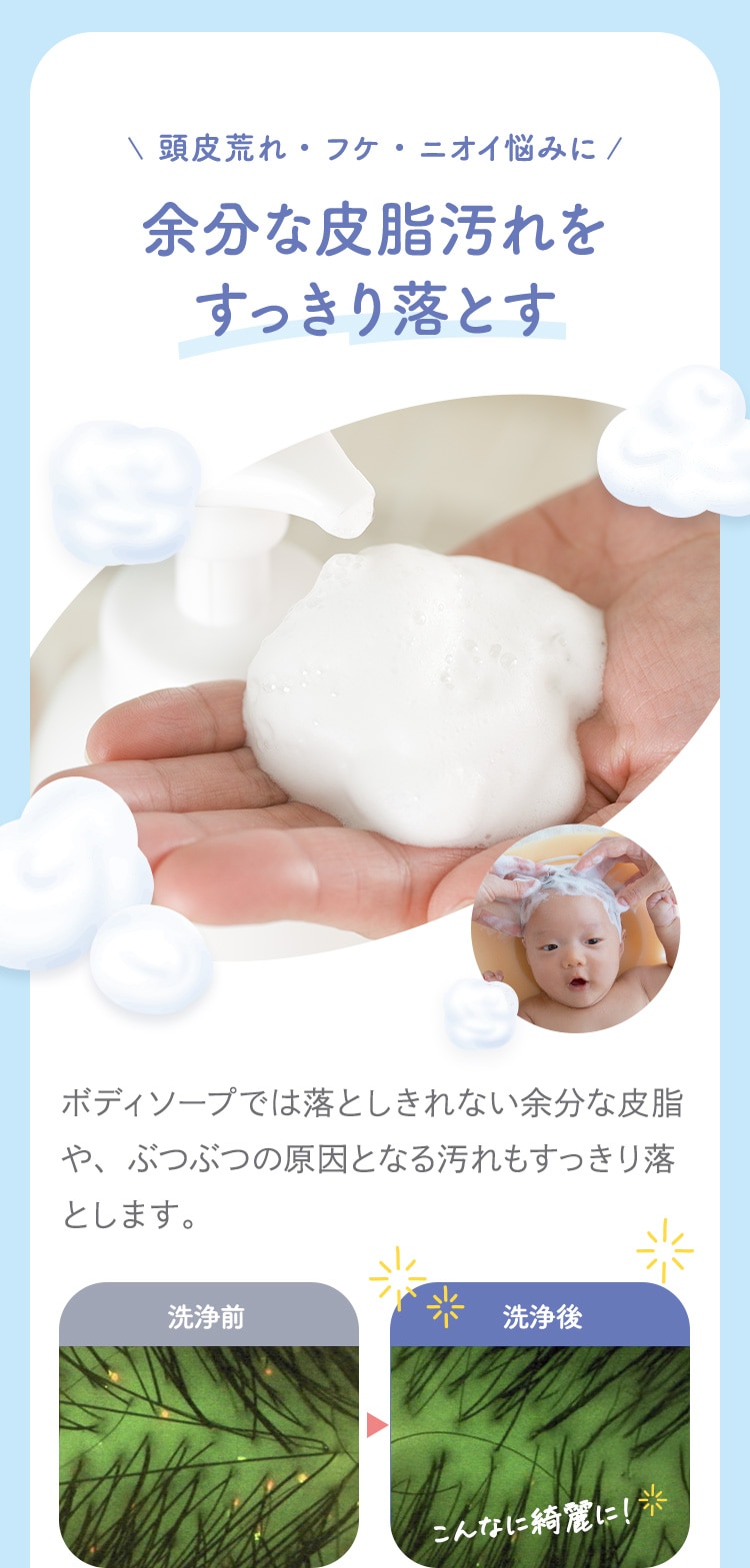 頭皮荒れ・フケ・ニオイ悩みに 余分な皮脂汚れをすっきり落とす