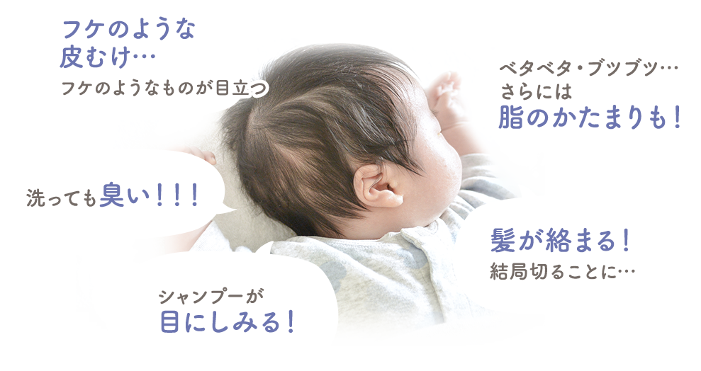フケのような皮むけ…フケのようなものが目立つ・洗っても臭い！！！・ベタベタ・ブツブツ…さらには脂のかたまりも！・シャンプーが目にしみる！・髪が絡まる！結局切ることに…