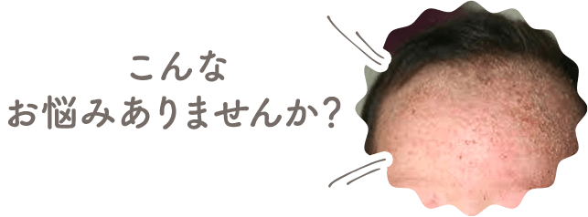 皮むけ・ベタつき・ニオイ・ブツブツ…赤ちゃんの頭にこんなお悩みありませんか?