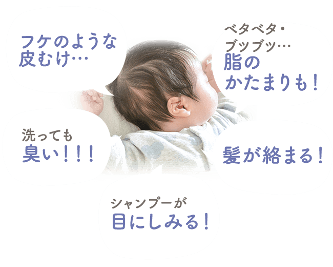 フケのような皮むけ…フケのようなものが目立つ・洗っても臭い！！！・ベタベタ・ブツブツ…さらには脂のかたまりも！・シャンプーが目にしみる！・髪が絡まる！結局切ることに…