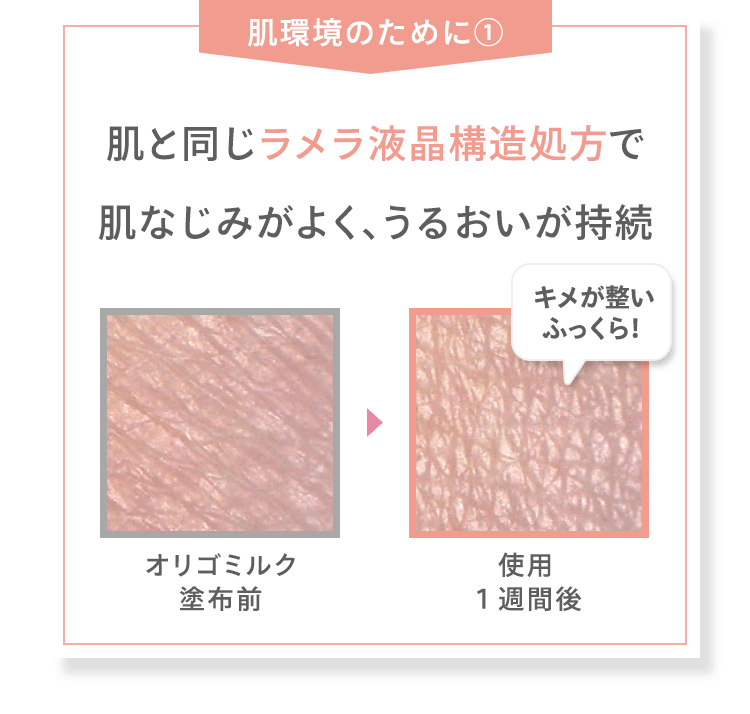 [肌環境のために(1)] 肌と同じラメラ液晶構造処方で肌なじみがよく、うるおいが持続