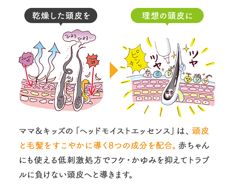 乾燥した頭皮を 理想の頭皮に ママ＆キッズの「ヘッドモイストエッセンス」は、頭皮と毛髪をすこやかに導く7つの成分を配合。赤ちゃんにも使える低刺激処方でフケ・かゆみを抑えてトラブルに負けない頭皮へと導きます。