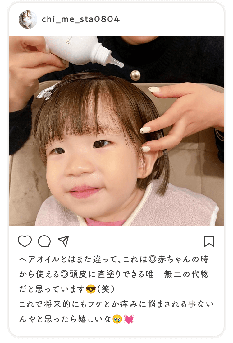 ヘアオイルとはまた違って、これは◎赤ちゃんの時から使える◎頭皮に直塗りできる唯一無二の代物だと思っています（笑）これで将来的にもフケとか痒みに悩まされる事ないんやと思ったら嬉しいな