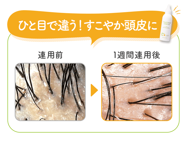 一目で違う！すこやか頭皮に！