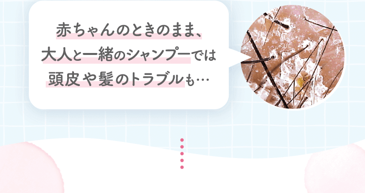 赤ちゃんのときのまま、大人と一緒のシャンプーでは頭皮や髪のトラブルも…