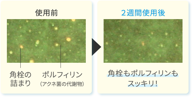 使用前と使用後の比較