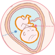 ベビーズエマルジョン®・厳選した「4種のヒト型セラミド