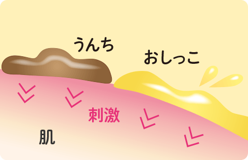 うんち、おしっこの付着