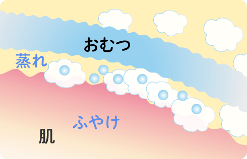 ムレによる肌のふやけ