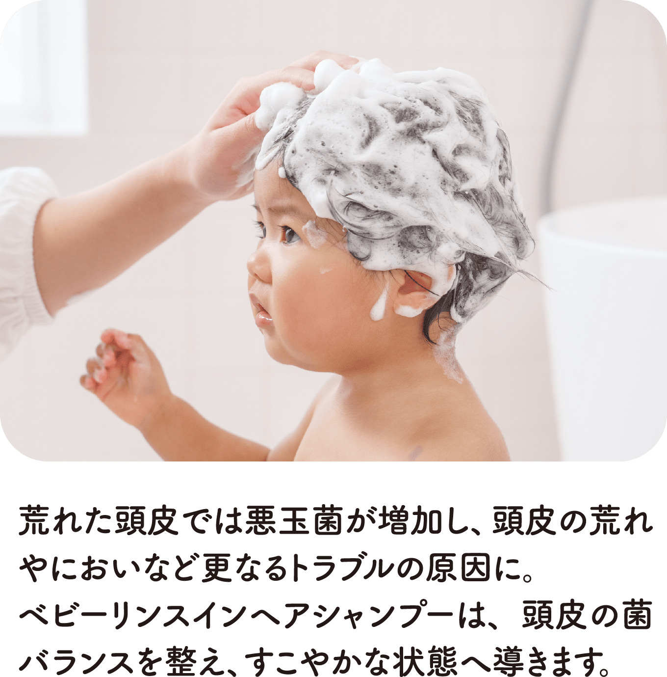 荒れた頭皮では悪玉菌が増加し、頭皮の荒れやにおいなど更なるトラブルの原因に。ベビーリンスインヘアシャンプーは、頭皮の菌バランスを整え、すこやかな状態へ導きます。