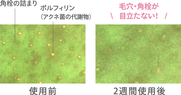 製品使用前と2週間使用後の比較