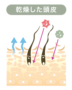 dry-scalp-image