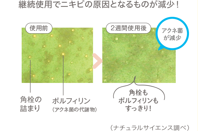 継続使用でニキビの原因となるものが減少!