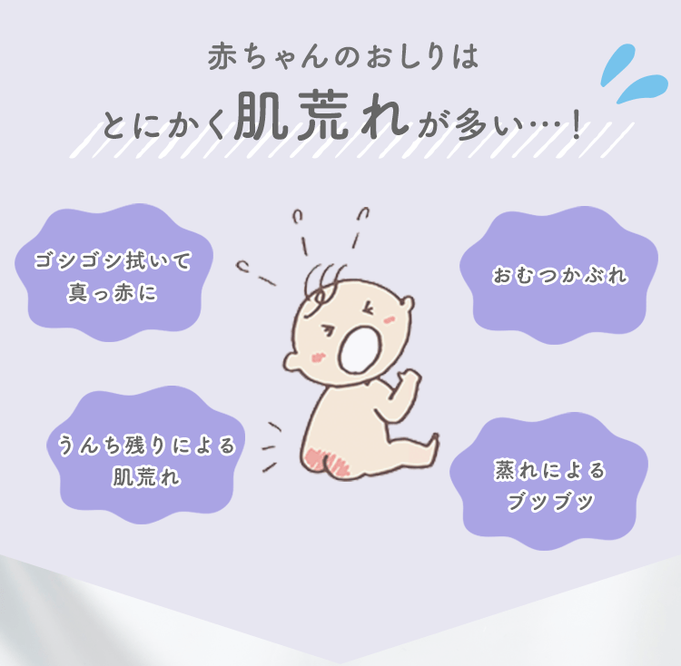 赤ちゃんのおしりはとにかく肌荒れが多い…！