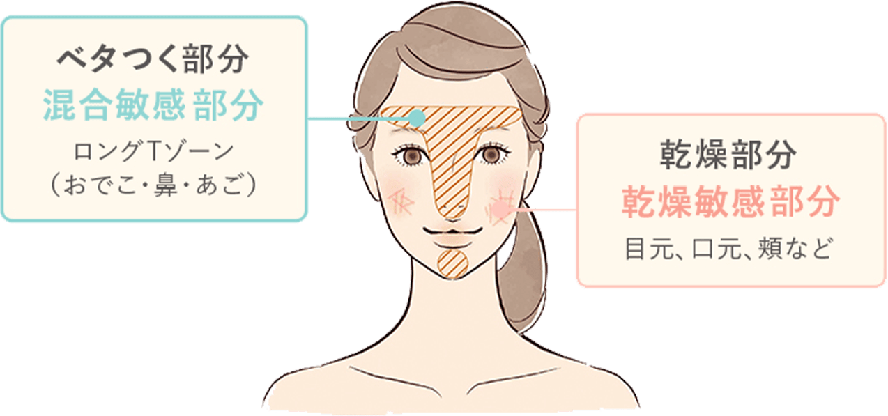 混合敏感肌の特徴の画像