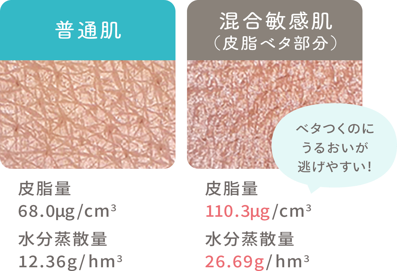普通肌と混合敏感肌（皮脂ベタ部分）の皮脂量と水分蒸散量の差