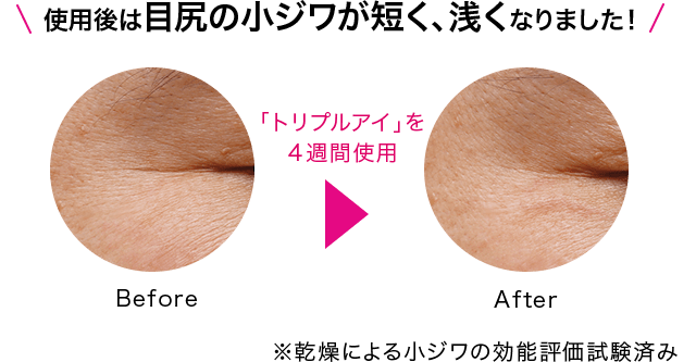 使用後は目尻の小ジワが短く、浅くなりました