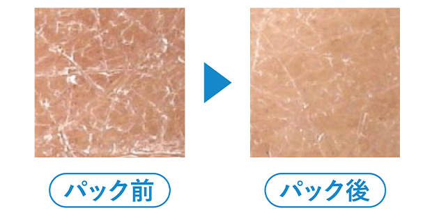 使用前 使用後 の毛穴