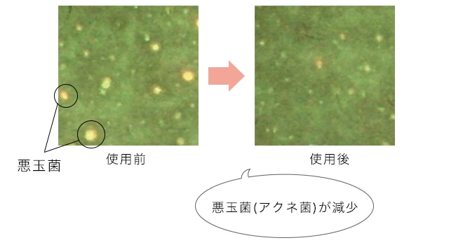 エクストラオリゴキュア１週間使用