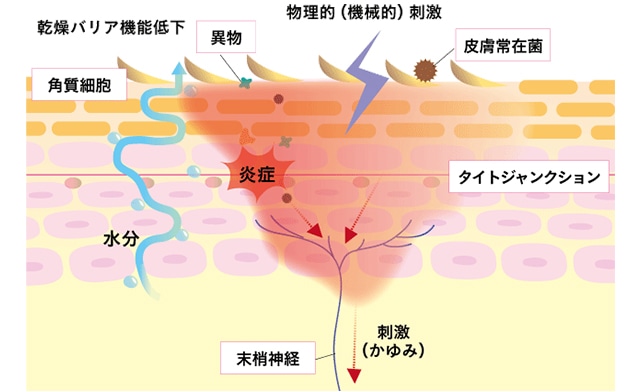 敏感肌のメカニズム