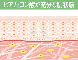 ヒアルロン酸が充分な肌状態