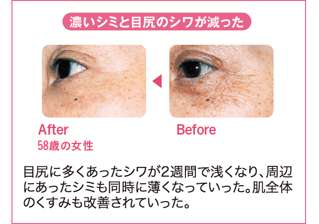 濃いシミと目尻のシワが減った