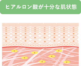 ヒアルロン酸が充分な肌状態