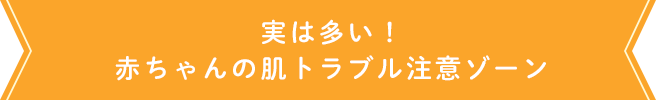 実は多い！赤ちゃんの肌トラブル注意ゾーン