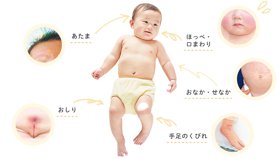 赤い 湿疹 お腹 赤ちゃん 乳幼児に起こりやすい「乳児湿疹」の基礎知識とアトピーの違い｜おむつの「GOO.N（グ〜ン）」